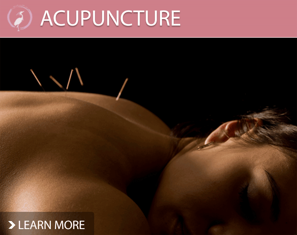 Acupuncture